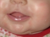 teeth-close-up.jpg