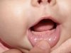 first-tooth-2.jpg